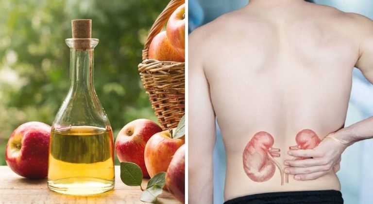 vinagre-de-manzana-salud-ignis-natura